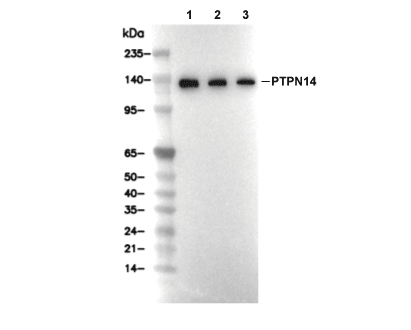 PTPN14 Antibody [H23F7] WB