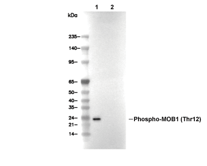 Phospho-MOB1 (Thr12) Antibody [F15P10] WB