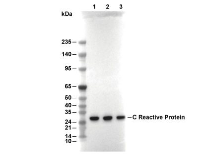 C Reactive Protein Antibody [N20E9] WB
