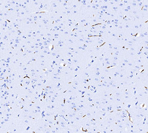f0031-IHC1