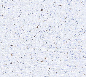 f0032-IHC1