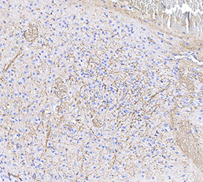 f0440-IHC1