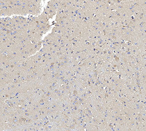 f0540-IHC1