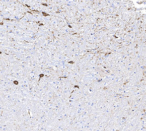 f0615-IHC1