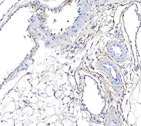f0765-IHC1