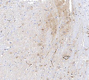 f0941-IHC1