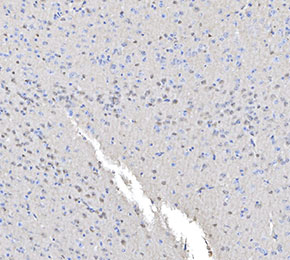 f1184-IHC1
