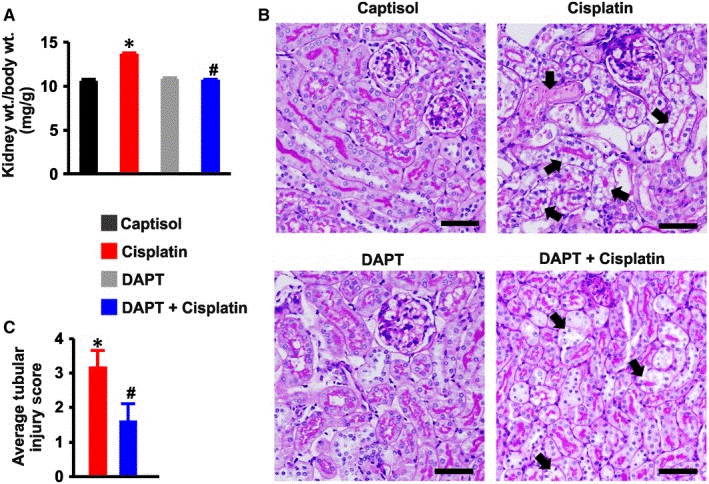 S4592-PAS-staining-1