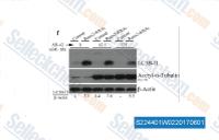 The serum-deprived control or Runx2 knockdown cells were treated with AR-42 for 6 hr at indicated concentrations. The LC3B-II, acetylated-&alpha;-tubulin, and &beta;-Actin levels were evaluated by western blotting. The &beta;-Actin normalized LC3B-II expression levels are indicated below each lane.