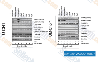 Western blot analysis confirm suppression of the biomarker p-EGFR upon treatment with EGFR TKIs in U-CH1 and UM-Chor1. Cells were serum-starved overnight before they were treated with a range of concentrations of the EGFR inhibitors for 4 h and then EGF-spiked (50 ng/ml) for 15 min. Endogenous controls (non-serum-starved, non-EGF-spiked), untreated controls (serum-starved, non-EGF-spiked) and vehicle controls (serum-starved, treated with 2.5% DMSO, EGF-spiked) were included. Phospho-EGFR was measured by western blot.