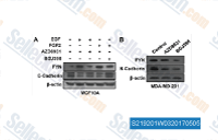 (A) Western blotting of FYN and E-cadherin expression in the MCF10A cells treated with EGF or FGF2 with or without their inhibitors AZD8931 or BGJ398. (B) Western blotting of FYN and N-cadherin expression in the MDAMB-231 cells treated with AZD8931 or BGJ398.