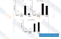 FXa inhibitor, apixaban, decreased thrombin levels after sciatic injury. Thrombin activity in mice sciatic nerve (A) Nerves were subjected to crush injury, 1 h after injury sciatic nerves were excised from the injured (black) and contralateral uninjured nerve (white). Nerves were placed in 96-well black microplate in buffer, with or without apixaban (10 &micro;M). Thrombin levels decreased significantly in the wells that contained apixaban. A two-way ANOVA indicated that apixaban significantly reduced the thrombin activity both in the uninjured and injured sides (F(1,35) = 19.276, p = 0.001 (uninjured n = 6, uninjured + apixaban n = 8, injured n = 18, injured + apixaban n = 8). (B) Thrombin activity 1 h after nerve injury in mice treated with apixaban (20 mg/kg). Thrombin levels were decreased significantly in mice that were treated with apixaban both in the uninjured (white) and injured (black) nerves (F(1,28) = 11.052, p = 0.02 by a two-way ANOVA) (uninjured n = 7, uninjured + apixaban n = 9, injured n = 7, injured + apixaban n = 9). (C) No significant effect on thrombin levels remained 1 day after a single apixaban injection (uninjured n = 18, uninjured + apixaban n = 8, injured n = 4, injured + apixaban n = 8).