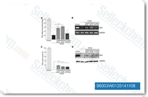 Endogenous full-length RP2 cDNA and protein can be restored in R120X fibroblasts by treatment with G418 and PTC124. (A) Treatment of R120X fibroblasts with a single 24 h dose of 500 uM G418 significantly increased RP2 mRNA levels compared with untreated cells. *P &le; 0.05, values are mean &plusmn; 2 SEM, N = 3. (B) Agarose gel showing products of RT-qPCR amplification. GAPDH was used as an amplification control. (C) Treatment of R120X fibroblasts with a single 24 h dose of 750 uM, 500 uM G418 or 10 ug/ml PTC124 significantly increased RP2 protein levels compared with untreated R120X cells. *P &le; 0.05, values are mean &plusmn; 2 SEM, N = 2. (D) Western blot showing increased RP2 protein levels in G418 and PTC124 treated R120X fibroblasts compared with untreated R120X cells.