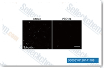 The effect of PTC124, compared with DMSO vehicle, was tested on the subunit c storage in TPP1 patient NPCs. Representative micrograph images are shown of cells immunostained to detect subunit c storage, following 72 h of treatment with 0.5% DMSO or 18 uM PTC124.