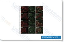 Control and R120X RPE cells were stained for endogenous G&beta;1 (green) and the membrane marker WGA (red). G&beta;1 plasma membrane localization is disrupted in R120X RPE cells, but restored with treatment of either G418 or PTC124. N = 3 independent experiments with 300 cells per experiment.