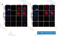 (e and f) Confocal immunofluorescence staining. U87 GSLCs and U251 GSLCs were seeded in suspension and treated with control, Tet, BIO or ICG-001 for 48 h. Blue fluorescence represents DAPI, red fluorescence represents &beta;-catenin, and green fluorescence represents TUNEL. Scale bars, 40 &mu;m