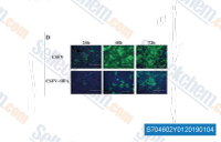 CSFV proliferation in ST cells with or without BFA was observed by IFA at 24, 48 and 72 hpi.