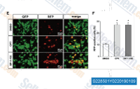 (E, F) The mPAC-MIP-RFP cells were infected with Ad-PNM, and treated with cryptotanshinone (CPT; 1 &mu;M), BP-1-102 (10 &mu;M), or DMSO. The percentage of RFP-positive cells among GFP-expressing cells was quantified. *, p < .05 versus DMSO.