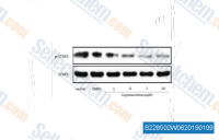 Immunoblot analysis of STAT3 in PC3 cells treated or not with cryptotanshinone at the indicated concentration for 30 min or DMSO as a control before incubation in culture medium.