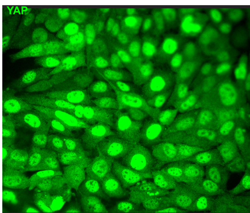 YAP Antibody [C6K11] | Primary Antibodies