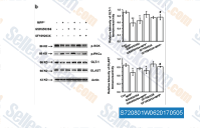 (b) Western blotting showing that PKC inhibitor increased GLT-1 and GLAST expression in MPP+-treated astrocytes. Results are expressed as the mean&plusmn;S.E. of at least three experiments. One-way ANOVA. **P<0.01, *P<0.05, #P<0.05. *Represents a significant difference between other group and control group; while #represents a significant difference between the indicated group and MPP+-treated astrocytes for 24&thinsp;h.