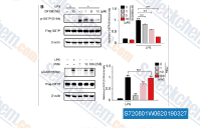 RAW264.7 cells were transfected with Flag-GSTP, followed by pretreatment with or without GF109203X for 2&thinsp;h, and then stimulated with LPS (500&thinsp;ng/ml) or phorbol-12-myristate-13-acetate (PMA) for 30&thinsp;min. Western blot analysis was performed by using anti-p-GSTP (S184) antibody.