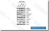BxPC-3 cells were treated with vehicle control, MK-1775 (MK), LY2603618 (LY) or MK-1775 plus LY2603618 for 48 h. Protein extracts were subjected to Western blotting and probed with anti-PARP, -p-CHK1, -CHK1, -p-CDC25C, -p-CDK1, -CDK1, -p-CDK2, -CDK2, -&gamma;H2AX, or -&beta;-actin antibody.