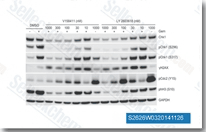 Biomarker changes induced in response to gemcitabine plus Chk1 inhibitor treatment in HT29 colon carcinoma cells. HT29 colon cancer cells were exposed to 50 nM gemcitabine (+) for 16 hours followed by increasing concentrations of Chk1 inhibitor for a further 24 hours. Protein expression was characterized by immunoblotting.