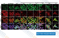 AURKA and PRL-3's time-scaled distributions in HCT116 were assessed by synchronization and released after serum starvation (SS) for 24 hours or NOC treatment for 12 hours. Arrows, mitotic cells.