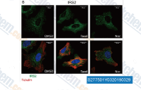 A and B, SUM159 cells were treated with either DMSO, 20 &mu;m Taxol, or 1 &mu;m nocodazole (Noc) for 1-2 h before fixation. Fixed cells were co-stained for IRS-2 (green) and tubulin (red).