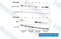 C. Western blot images of GBC cells treated with 1.25 &mu;M PTC-209 for 72 h (n = 4, cropped). Abbreviations: BMI1: BMI1 polycomb ring finger oncogene; h: hours; H2AK119ub: mono-ubiquitylation of histone 2A at lysine 119; PRC1: polycomb repressive complex 1; RING1B: ring finger protein 2.