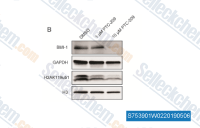 Western blot analysis of U87MG cell lysates following PTC-209 (1 &mu;M and 10 &mu;M) or vehicle control (DMSO) treatment for 4 days.