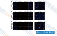 Induction of apoptosis by HDAC and DNMT1 inhibitors. a-c/ Membrane permeability apoptosis and necrosis assays were performed in which apoptotic cells positively stain for YO-PRO1 and necrotic cellspositively stain for PI. Cells undergoing late apoptosis positively stain for both YO-PRO1 and PI. Nuclei were counterstained with Hoechst 33342. Apoptosis assay results are shown for Daoy cells that were exposed to: a/DMSO, b/2 &mu;Mparthenolide and c/2 &mu;Mparthenolide plus 33 nM 5-azadC, each for 24 h and 48 h, as indicated. d&ndash;f Annexin Vapoptosis assays of Daoy cells exposed to (d) DMSO, (e) 2 &mu;Mparthenolide and (f) 2 &mu;M parthenolide plus 33 nM 5-aza-dC for 24 h. Nuclei were counterstained with DAPI.