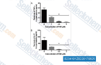 PAR inhibited the production of TNF-&alpha; and IL-17 in vitro in a dose dependent manner. Lymph node MNCs harvested from EAN rats on day 8 p.i. were cultured in the presence of BPM and a series of concentrations of PAR. 72 h later, culture supernatants were collected and the levels of TNF-&alpha; and IL-17 were detected by ELISA. The results are expressed as mean &plusmn; SD (*p < 0.05, **p < 0.01). Data represented three experiments.
