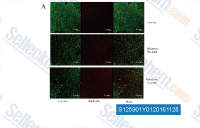 (A) CLSM images of Porphyromonas gingivalis biofilm formed in the presence of melatonin and ramelteon at sub-MIC concentrations. Biofilm-forming cells were stained using the Live/Dead Bacterial Viability Kit. Dead cells were stained red, whereas live bacteria were stained green. In the presence of 50 &mu;g/mL or 25 &mu;g/mL ramelteon, the areas of biofilm formation were narrower than that of vehicle controls. Bars = 50 &mu;m.