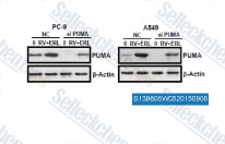 PC-9 and A549 cells were treated with 100 nM siRNA against PUMA and 100 nM negative control (NC) siRNA for 12 h, and treated with the indicated concentrations of RV and ERL in combination for an additional 48 h. The knockdown effects on PUMA were confirmed by Western blot analysis.
