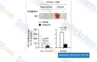 AR staining of non-CAVD and CAVD patient hVICs in the presence or absence of Sitagliptin (100 &mu;M) after 4 weeks of osteogenic stimulation. The bar graph presents the AR-positive area measured in each culture dish.