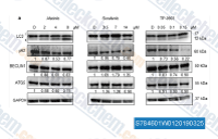 Increasing concentrations of Afatinib, Sorafenib and TP-0903 were used for the treatment of SH-SY5Y cells for 24 h (upper numbers indicate the concentrations used in &mu;M; D&thinsp;=&thinsp;DMSO). Levels of main autophagy regulators were evaluated by western blot. GAPDH served as a loading control protein. Numbers under the single protein indicate relative expressions obtained by densitometry measurement, normalized to GAPDH, and compared to the control samples (DMSO&thinsp;=&thinsp;1).