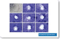 A representative experiment for tandutinib is shown. A: The control group after 0 h. B: The control group after 24 h. C: Treatment with 0.125 ug/ml tandutinib. D: Treatment with 0.25 ug/ml tandutinib. E: Treatment with 0.5 ug/ml tandutinib. F: + Treatment with 1 ug/ml tandutinib. G: Treatment with 2 ug/ml tandutinib. H: Treatment with 5 ug/ml tandutinib. I: Treatment with 10 ug/ml tandutinib. (B) + (C) *, P < 0.05, compared with the respective uninhibited cells. The bars represent the mean ?SD.