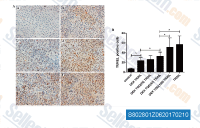 DEX protects L-02 cells from TRAIL-induced apoptosis by upregulating P-gp. Apoptosis was evaluated using a TUNEL assay, and the number of TUNEL-positive cells in each group were counted. (A) Representative photomicrographs of the TUNEL assay. L-02 cells were divided into six groups based on their treatment regimens, (a) control untreated group, (b) pretreated with 10 &micro;M DEX for 24 h, followed by incubation with TRAIL for 24 h, (c) pretreatment with 10 &micro;M DEX for 24 h, followed by incubation with TRAIL and 25 nM TQD for 24 h, (d) pretreated with 10 &micro;M DEX for 24 h, followed by incubation with TRAIL and 50 nM TQD for 24 h, (e) pretreated with 10 &micro;M DEX for 24 h, followed by incubation with TRAIL and 100 nM TQD for 24 h, and (f) incubated with TRAIL for 24 h. All the groups were treated with TRAIL for the induction of apoptosis, with the exception of the control group. Magnification, &times;200. (B) Quantitative analysis of the levels of apoptosis. Data are presented as the mean &plusmn; standard deviation. *P<0.05. DEX, dexamethasone; TRAIL, tumor necrosis factor-related apoptosis-inducing ligand; TQD, tariquidar; TUNEL, terminal deoxynucleotidyl transferase dUTP nick end labeling.