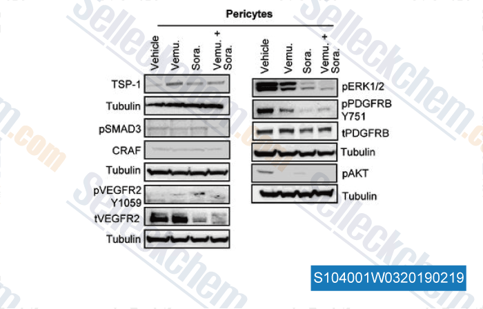 PDGFR Inhibition | PDGFR Inhibitor Review